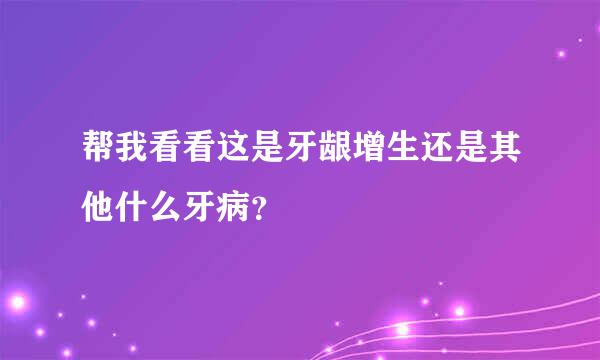 帮我看看这是牙龈增生还是其他什么牙病？