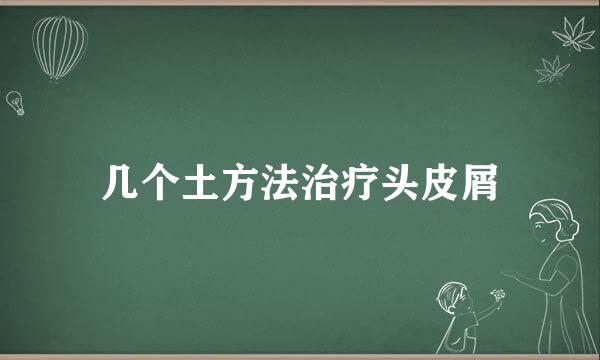 几个土方法治疗头皮屑