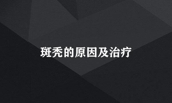 斑秃的原因及治疗