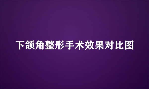 下颌角整形手术效果对比图