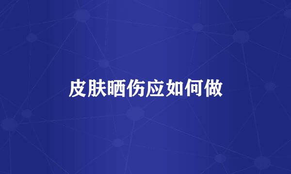 皮肤晒伤应如何做