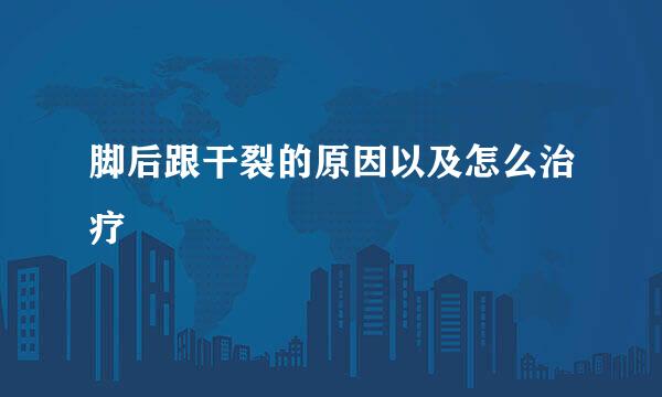 脚后跟干裂的原因以及怎么治疗