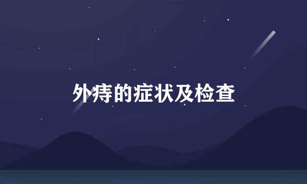 外痔的症状及检查