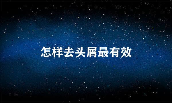 怎样去头屑最有效