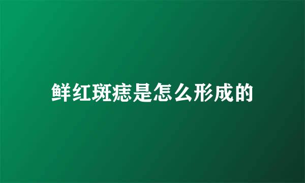 鲜红斑痣是怎么形成的