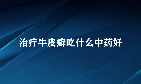 治疗牛皮癣吃什么中药好