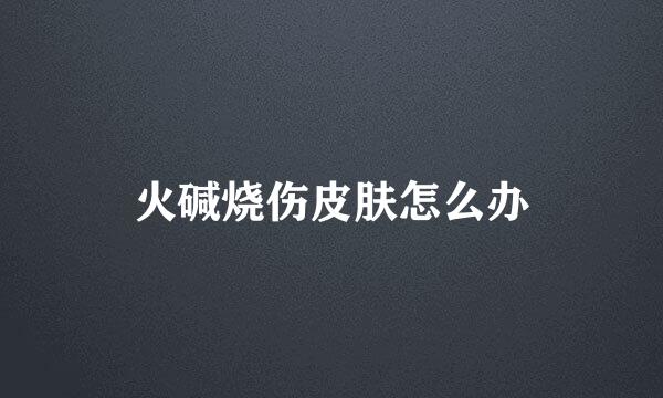 火碱烧伤皮肤怎么办