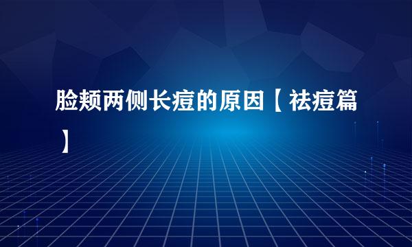 脸颊两侧长痘的原因【祛痘篇】