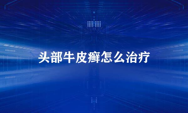 头部牛皮癣怎么治疗