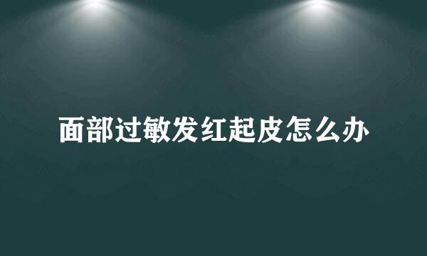 面部过敏发红起皮怎么办