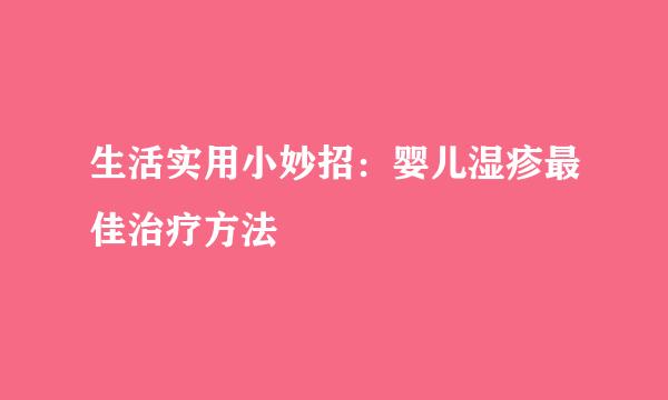 生活实用小妙招：婴儿湿疹最佳治疗方法