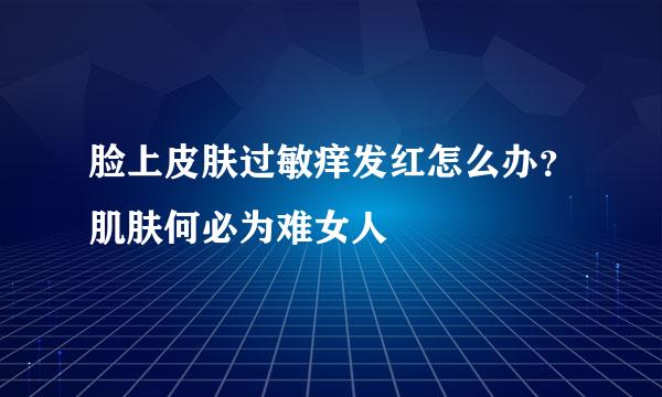 脸上皮肤过敏痒发红怎么办？肌肤何必为难女人