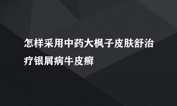 怎样采用中药大枫子皮肤舒治疗银屑病牛皮癣