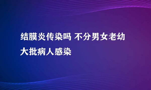 结膜炎传染吗 不分男女老幼大批病人感染