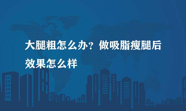大腿粗怎么办？做吸脂瘦腿后效果怎么样