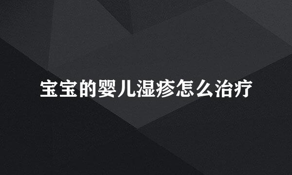 宝宝的婴儿湿疹怎么治疗