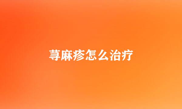 荨麻疹怎么治疗