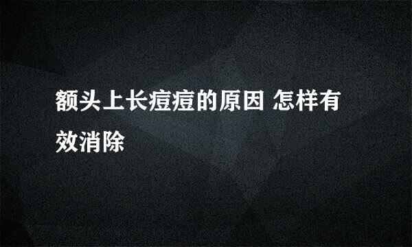 额头上长痘痘的原因 怎样有效消除