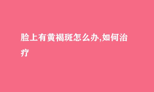 脸上有黄褐斑怎么办,如何治疗